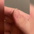 How to Fix a Broken Nail​