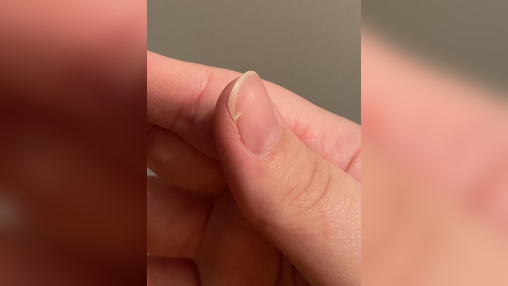 How to Fix a Broken Nail​
