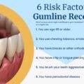 How to Fix Receding Gums​